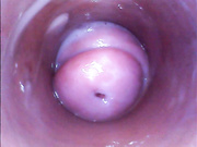Amusing information Endoscopy in pussy video nothing tell Pity, Endoscopy in pussy video question